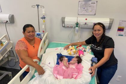 Gêmeas siamesas do Amazonas recebem alta da UTI após cirurgia complexa de separação
