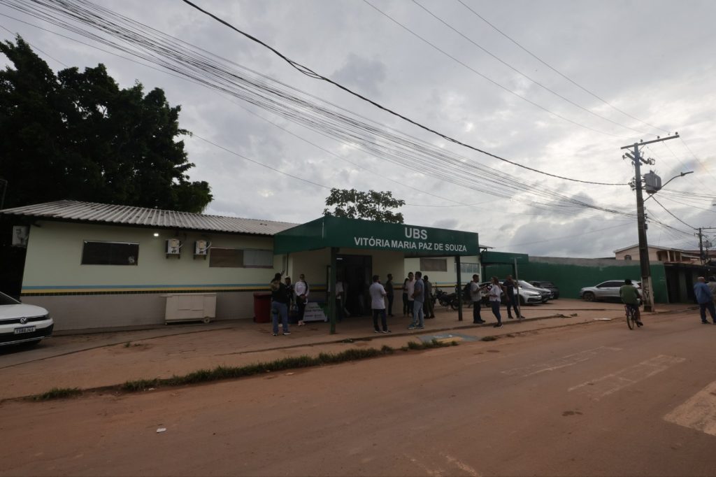 Governador Wilson Lima vistoria mutirão de cirurgias de catarata do Opera+ Amazonas em Iranduba
