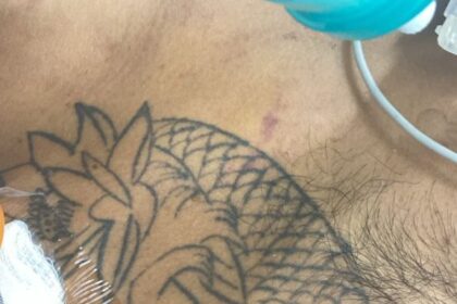 Hospital João Lúcio pede ajuda da população para identificar paciente internado em estado gravíssimo