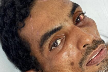 Homem deu entrada na unidade pelo SAMU, após sofrer choque elétrico