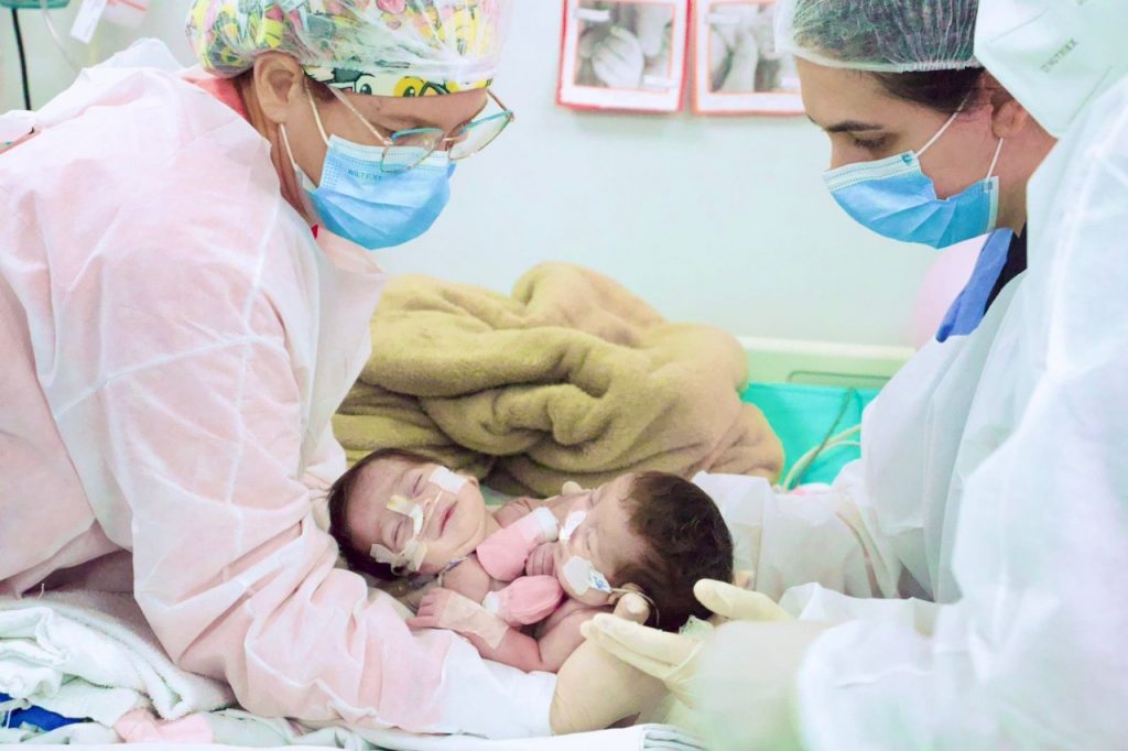 Siamesas que nasceram na maternidade Ana Braga completam um ano e atestam avanço da saúde no Amazonas