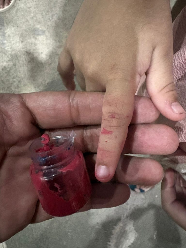 Corpo de Bombeiros atende criança com dedo preso em frasco de plástico em Manaus